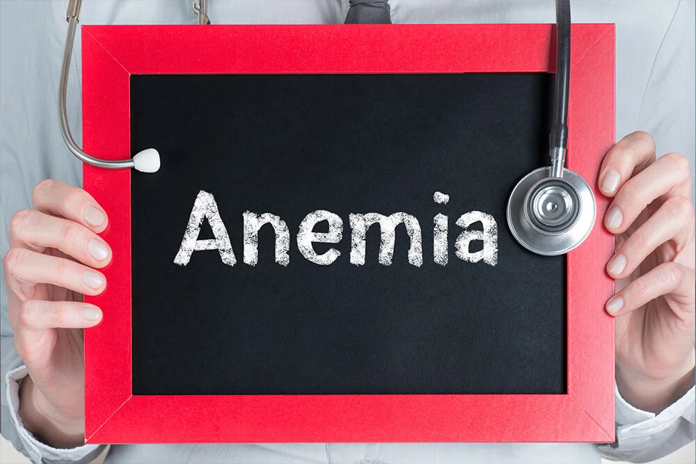 Anemia