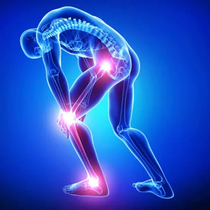 Arthritis Pain
