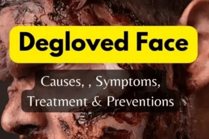 Degloved Face