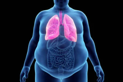 Obese man's lung, illustration. | Ozembic