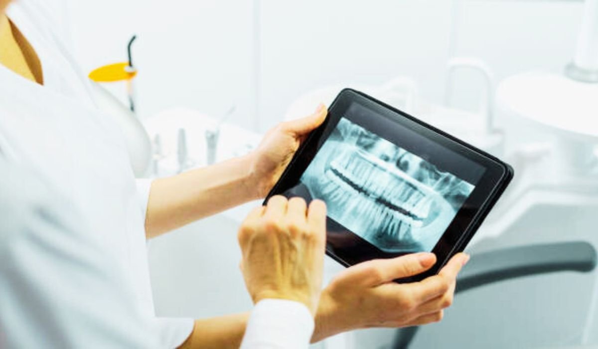 5 Smart Strategies for Inexpensive Dental Implants to Help You Achieve