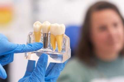 Dental Implants Done Right Tucson's 4 Can't-Miss Centers of Excellence